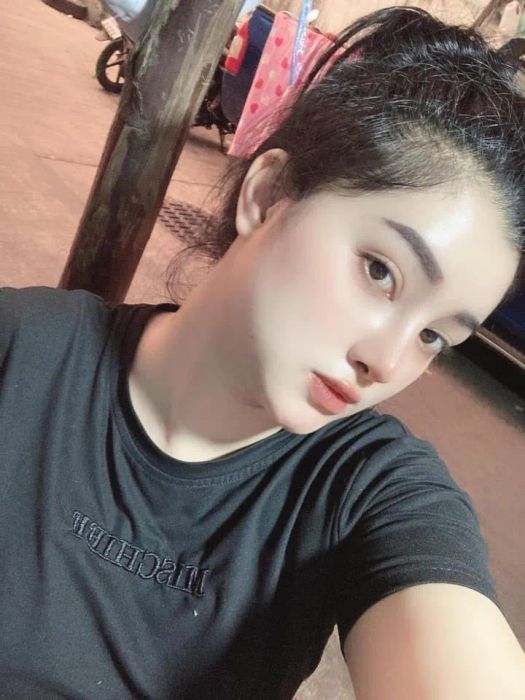 Mới nâng mũi về, đừng khoe mũi, tuyệt đối đừng nghe mấy lời nhận xét lúc mũi sưng với bầm ảnh 1