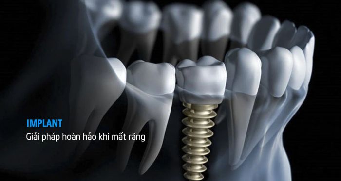 Hệ thống máy móc tiên tiến tại Nha Khoa Linh Thiện