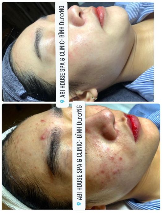 Không gian trị liệu sang trọng tại Abi House Spa & Clinic