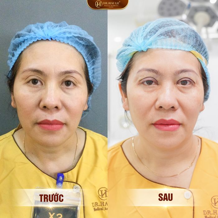Viện Thẩm Mỹ Y Khoa Dr.Hải Lê - Hình ảnh 1