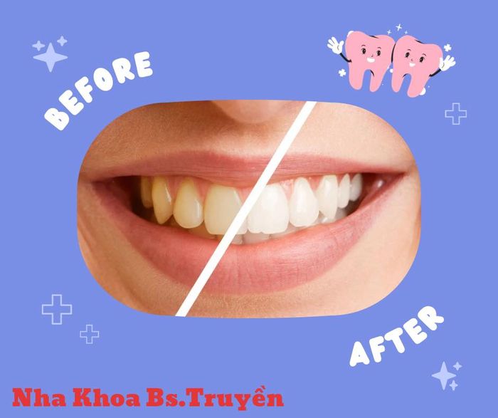 Nha Khoa Bs.Truyền Trà Vinh ảnh 1