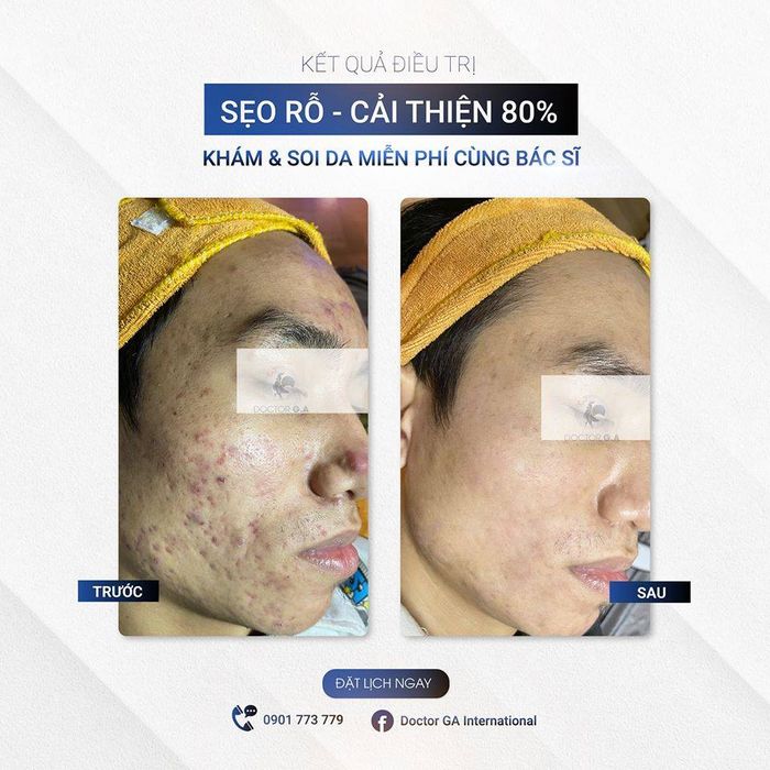 Không gian sang trọng đạt chuẩn tại Gà Spa Bình Dương