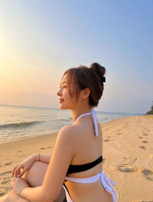 Sau khi sửa mũi, hình dáng của tôi đã thay đổi như thế này.