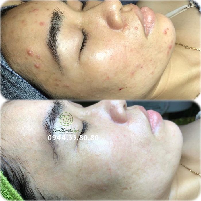 Hình ảnh không gian sang trọng tại Lan Thanh Spa