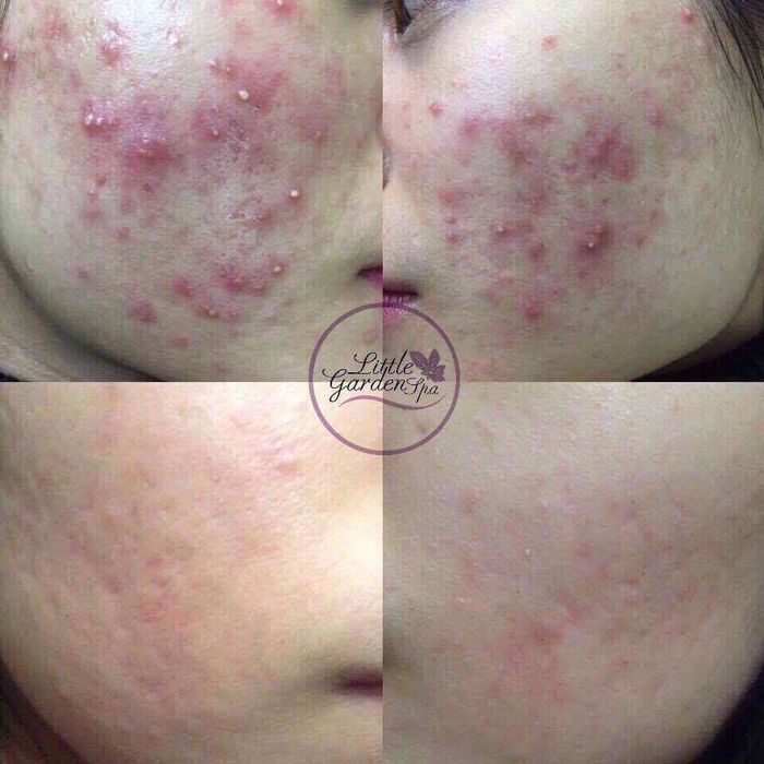 Không gian sang trọng chuẩn Hàn tại Little Garden Spa