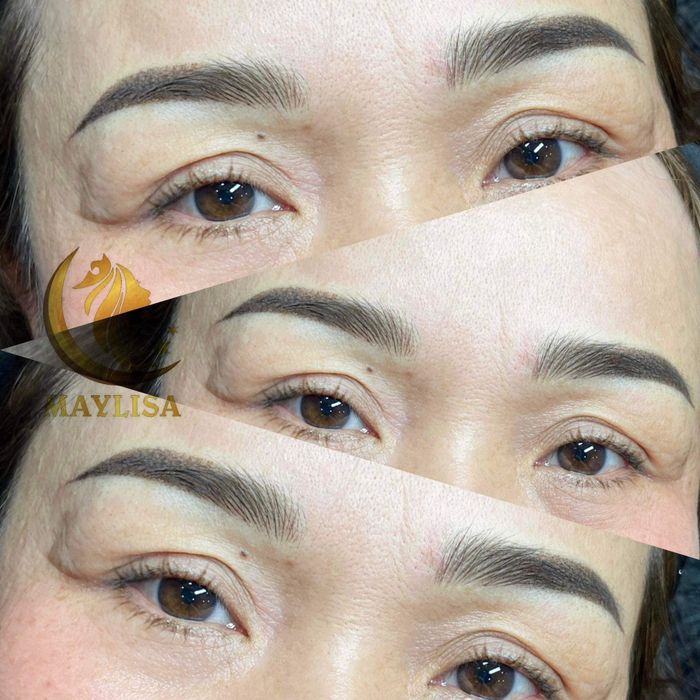 Viện Thẩm Mỹ Quốc Tế Maylisa Hình Ảnh 2