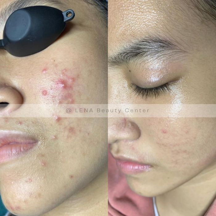 LENA Beauty Center Hình Ảnh 1
