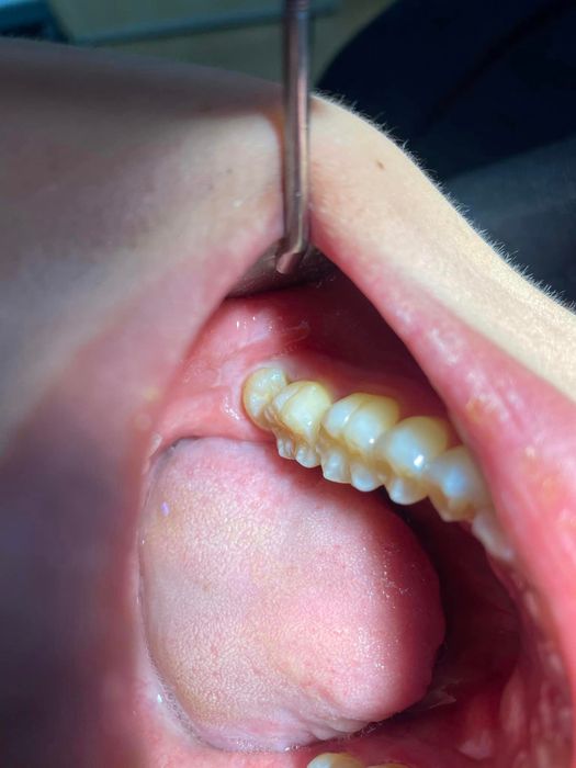 Quy trình thăm khám chuẩn quốc tế tại Nha Khoa 108