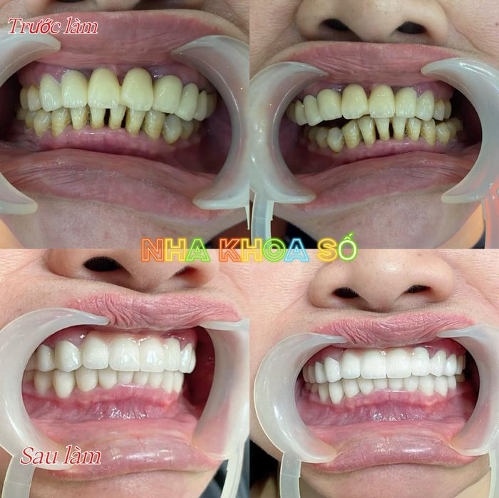 Hình ảnh phòng khám hiện đại tại Nha Khoa 108