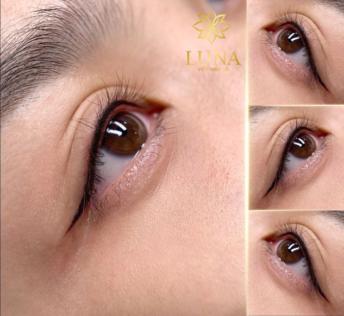 Viện Thẩm Mỹ Luna ảnh 2