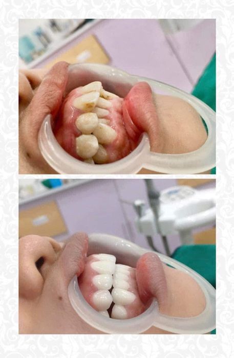 Không gian hiện đại và chuyên nghiệp tại Nha Khoa Nụ Cười