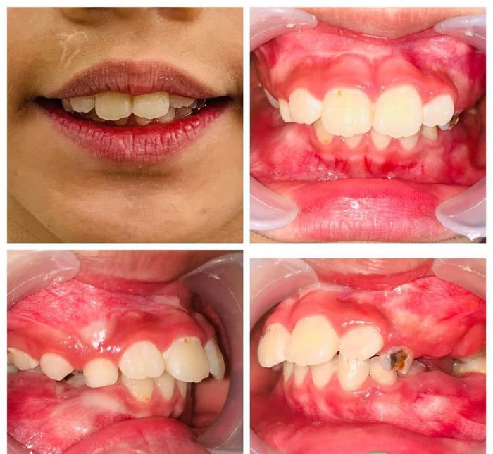 Hệ thống phòng điều trị đạt chuẩn tại Nha Khoa Huy Linh
