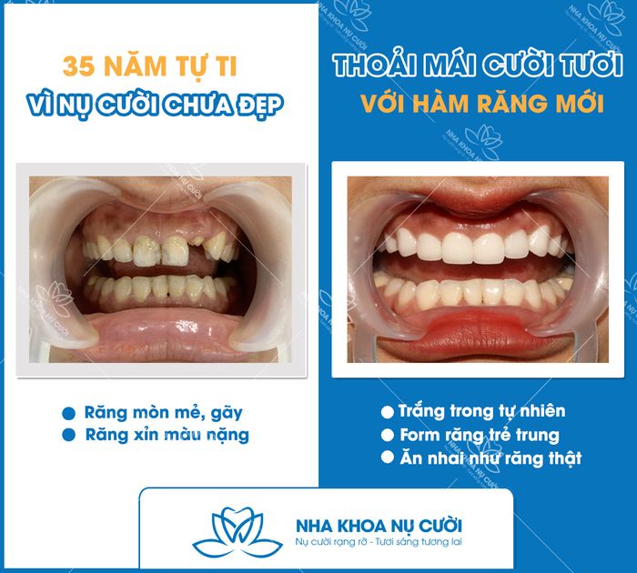 Hệ thống trang thiết bị tiên tiến tại Nha Khoa Nụ Cười