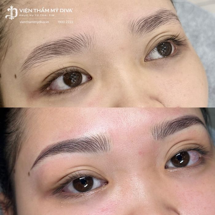 Viện Thẩm Mỹ DIVA Hình Ảnh 2