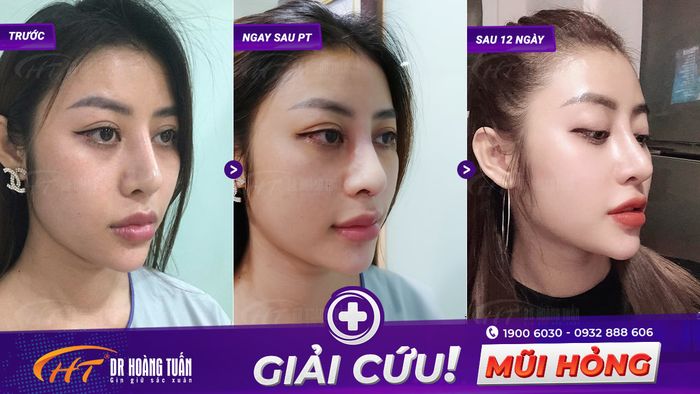 Thẩm mỹ Hoàng Tuấn ảnh 1
