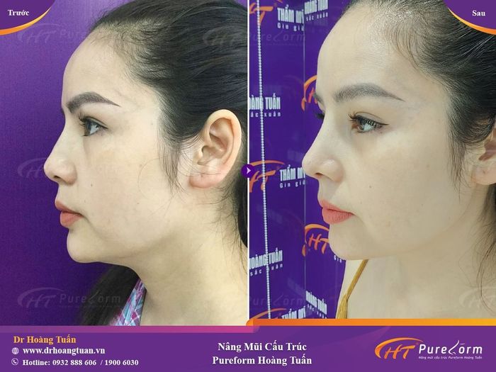 Thẩm mỹ Hoàng Tuấn ảnh 2