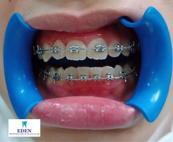 Hình ảnh không gian hiện đại tại EDEN Dental Care