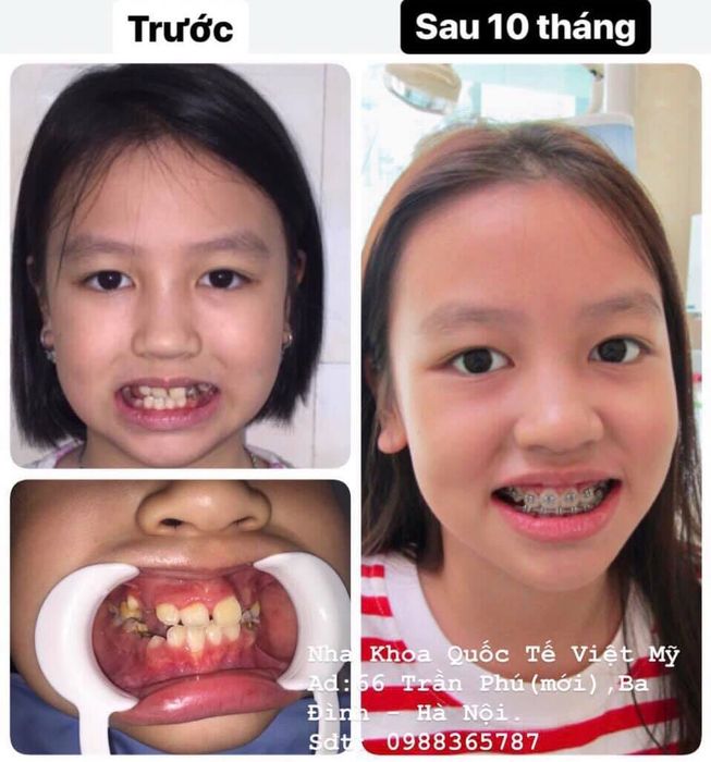Hình ảnh phòng khám đạt chuẩn quốc tế tại Nha Khoa Việt Mỹ