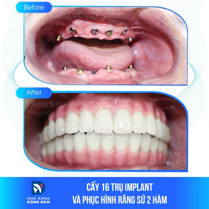 Hình ảnh thực tế Nha khoa Đông Nam