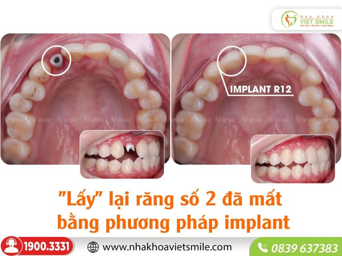 Hệ thống trang thiết bị tân tiến tại Nha khoa Việt Smile