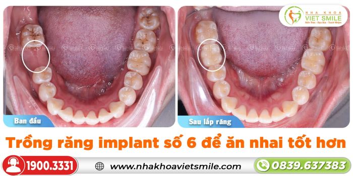 Không gian hiện đại tại Nha khoa Việt Smile