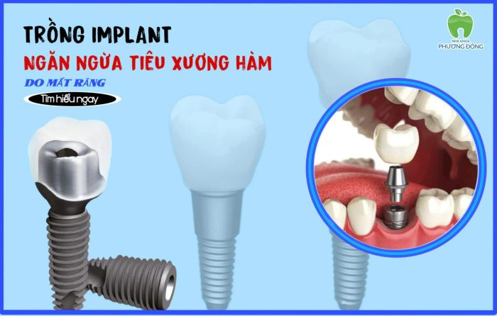 Hệ thống trang thiết bị tân tiến tại Nha Khoa Phương Đông