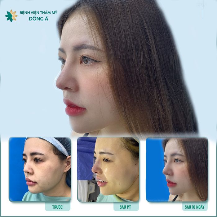 Bệnh Viện Thẩm Mỹ Đông Á ảnh 2