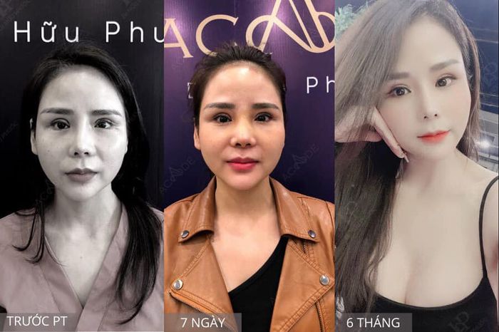 Phòng khám Chuyên khoa Thẩm mỹ Acade Clinic - Dr. Hữu Phước ảnh 2