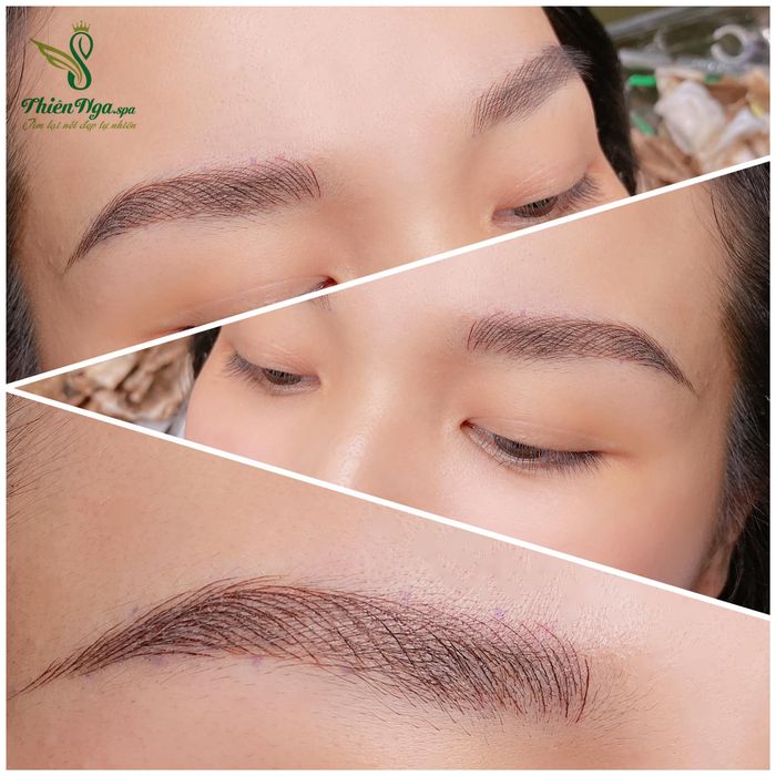 Hình ảnh Thẩm Mỹ Thiên Nga ảnh 1