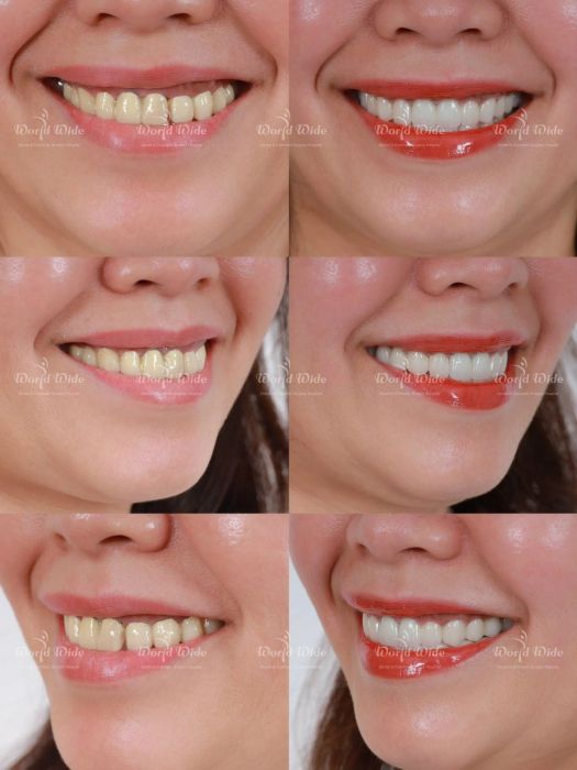 Ảnh Bệnh viện Răng hàm mặt Worldwide 1