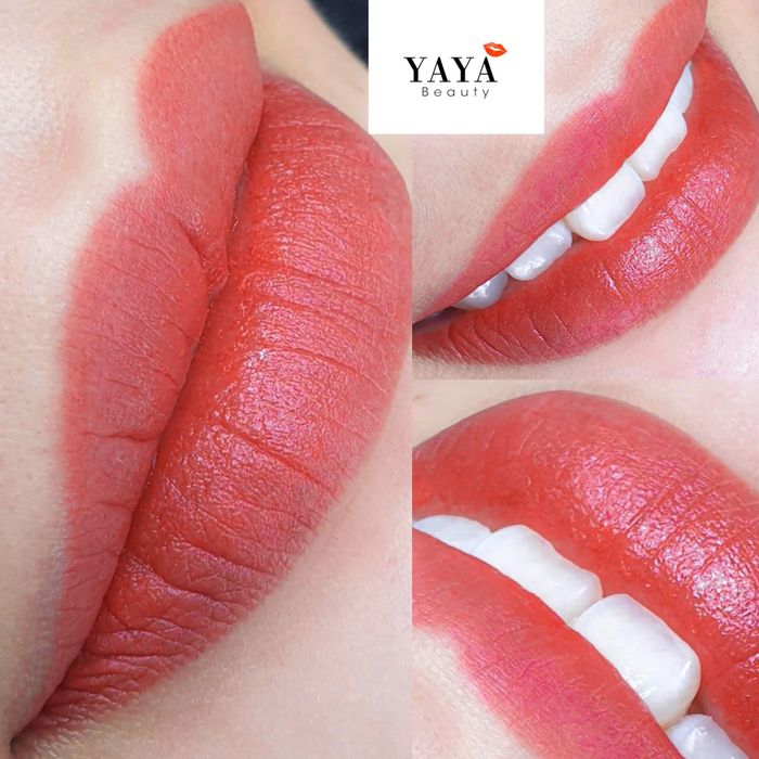 VIỆN THẨM MỸ YAYA Beauty Center - Hình ảnh chuyên nghiệp ảnh 1