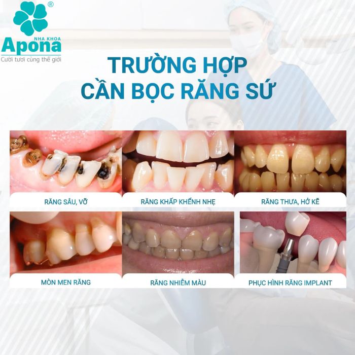 Ảnh Nha khoa Apona - Chuyên răng toàn sứ thẩm mỹ & Implant 1