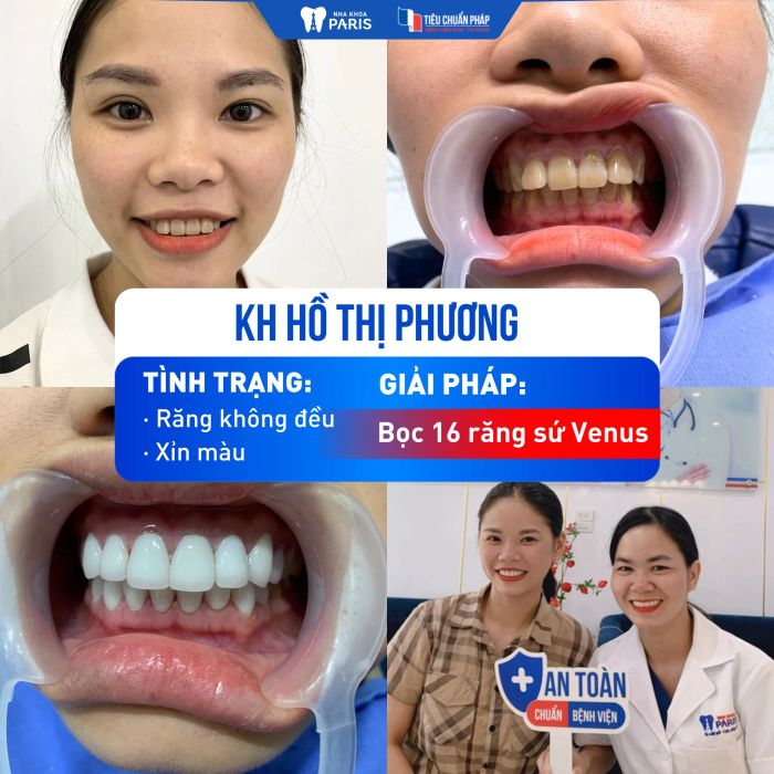 Nha Khoa Paris ảnh 1