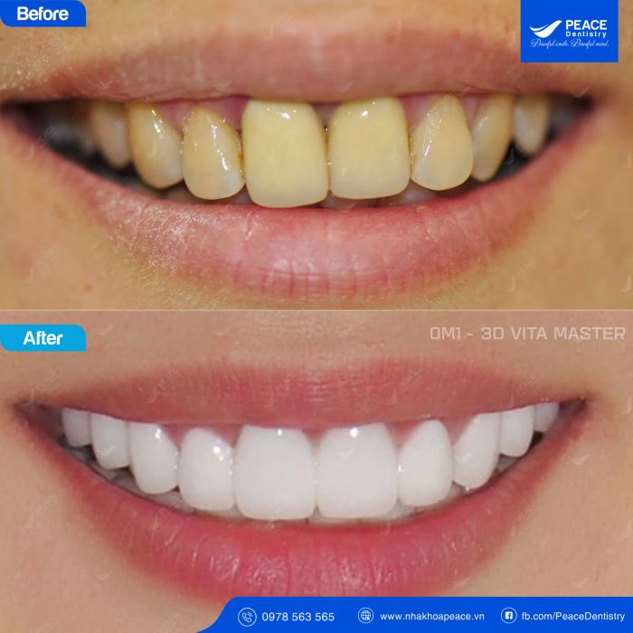 Ảnh Peace Dentistry 2