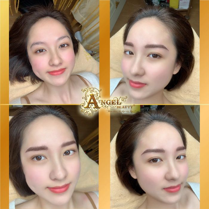 Hình ảnh khách hàng trải nghiệm dịch vụ tại Angel Beauty Bình Tân