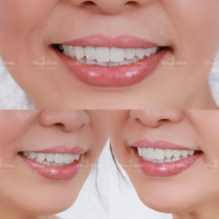 Ảnh Bệnh viện Răng hàm mặt Worldwide 2