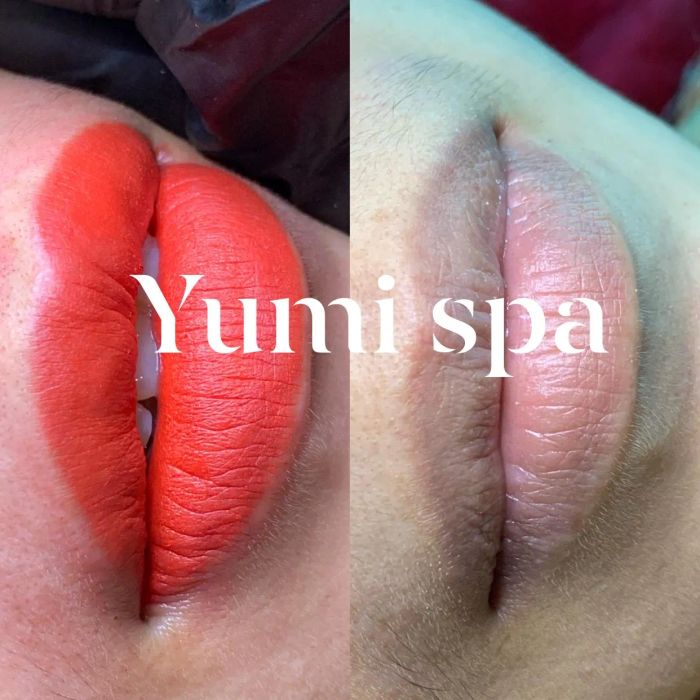 Yumi Spa - Hình Ảnh 1