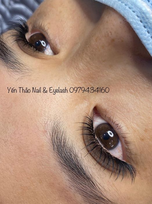 Hình ảnh dịch vụ chuyên nghiệp tại Yến Thảo Beauty
