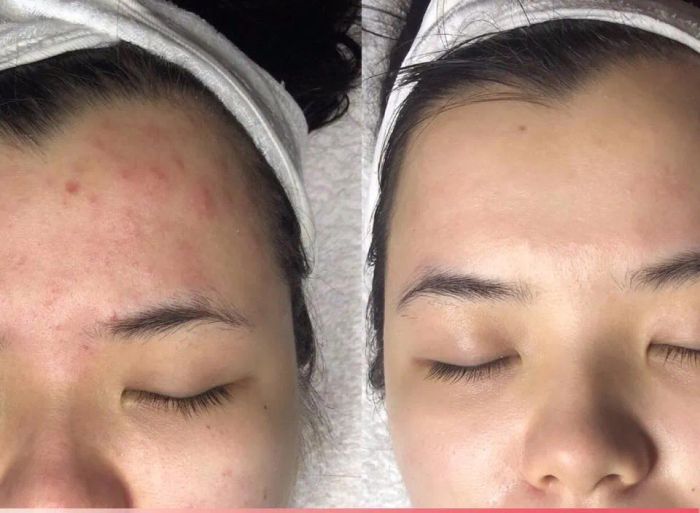 Quế Spa Trị Liệu - Chăm Sóc Da Hiệu Quả ảnh 2