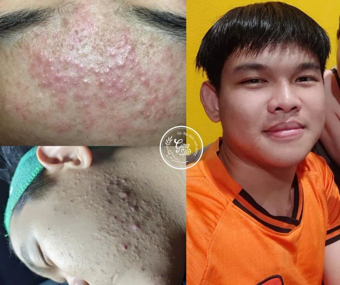 Gừng Spa - Nuôi Dưỡng Vẻ Đẹp Từ Thiên Nhiên ảnh 2