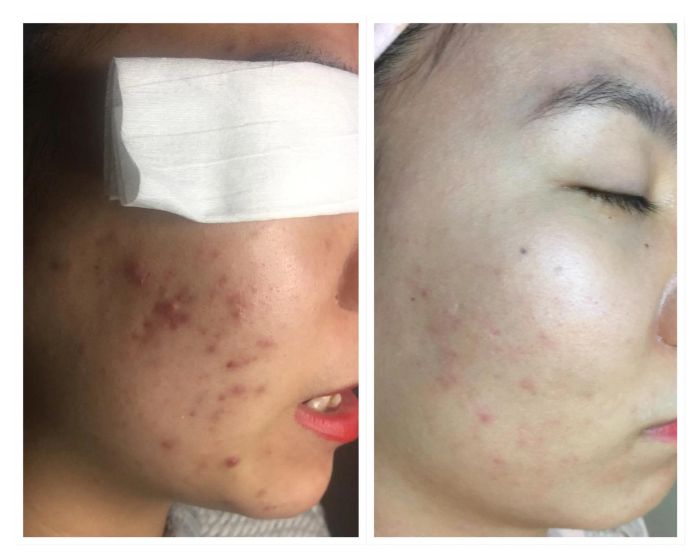 Nàng Spa - Chăm Sóc Da Toàn Diện ảnh 2