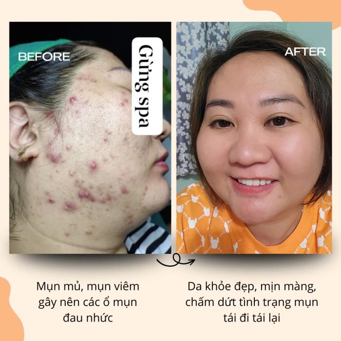 Gừng Spa - Nuôi Dưỡng Vẻ Đẹp Từ Thiên Nhiên ảnh 1