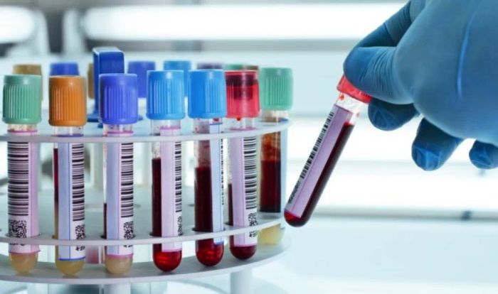 Hình ảnh dịch vụ xét nghiệm tại nhà của Jio Health