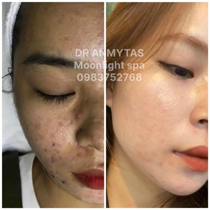 Moonlight Spa - Làm Đẹp Tự Nhiên ảnh 2