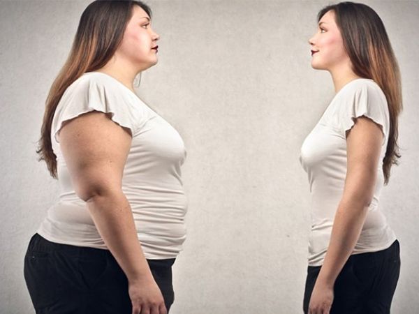 Hình ảnh minh họa quy trình điều trị béo phì