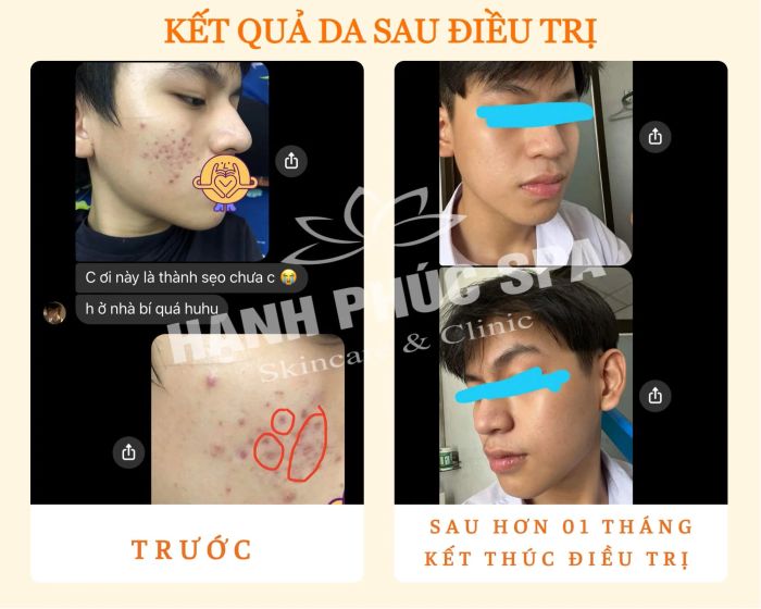 Hạnh Phúc Spa (Ảnh 2)