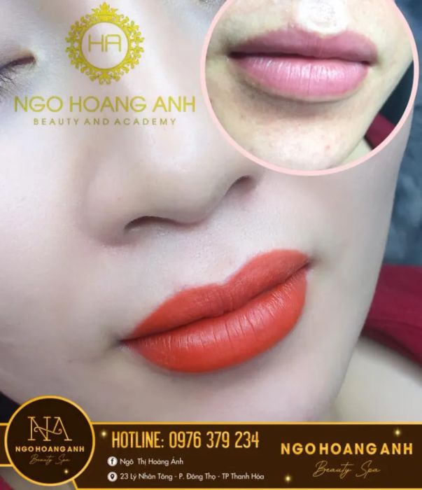 Kết quả phun môi collagen tự nhiên tại Ngô Hoàng Ánh Beauty