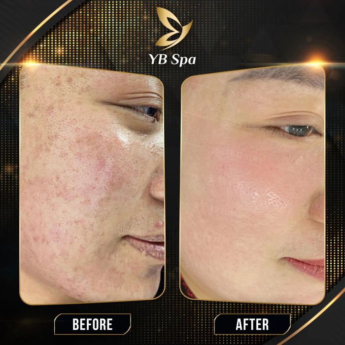Viện Thẩm Mỹ YB Spa Long An (Ảnh 2)