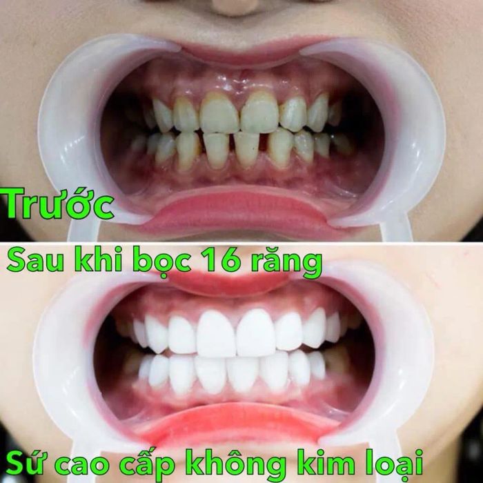 Hình ảnh thực tế tại Nha Khoa Hồng Nguyên - Sóc Trăng
