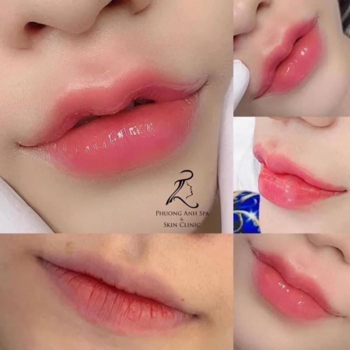 Viện Thẩm Mỹ Phương Anh - Khoảnh khắc đẹp qua ống kính (Ảnh 1)